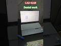 cad cam dental work #rap #dentalknowledge #shortsfeed