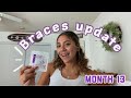 Braces update month 13 | new band pattern