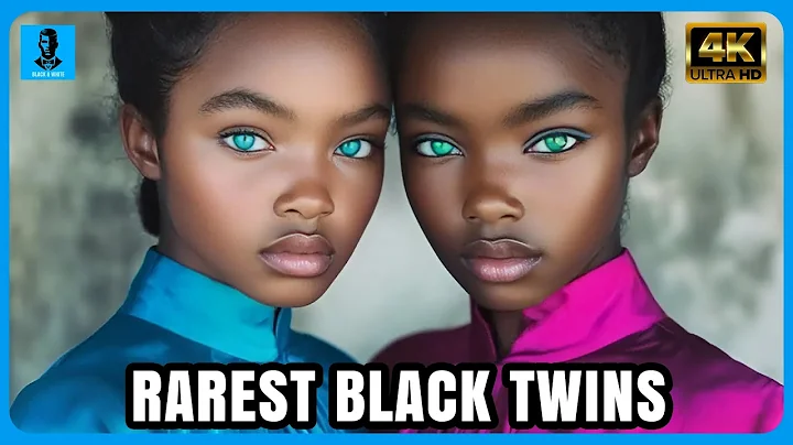 10 Rarest Black Twins Who Are One In a Million | Black Celebrities
