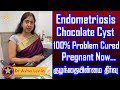    endometriosis  chocolate cyst treatment