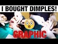 FACIAL COSMETIC SURGERY VLOG! HOW TO GET DIMPLES│ DIMPLEPLASTY PROCEDURE EXPERIENCE