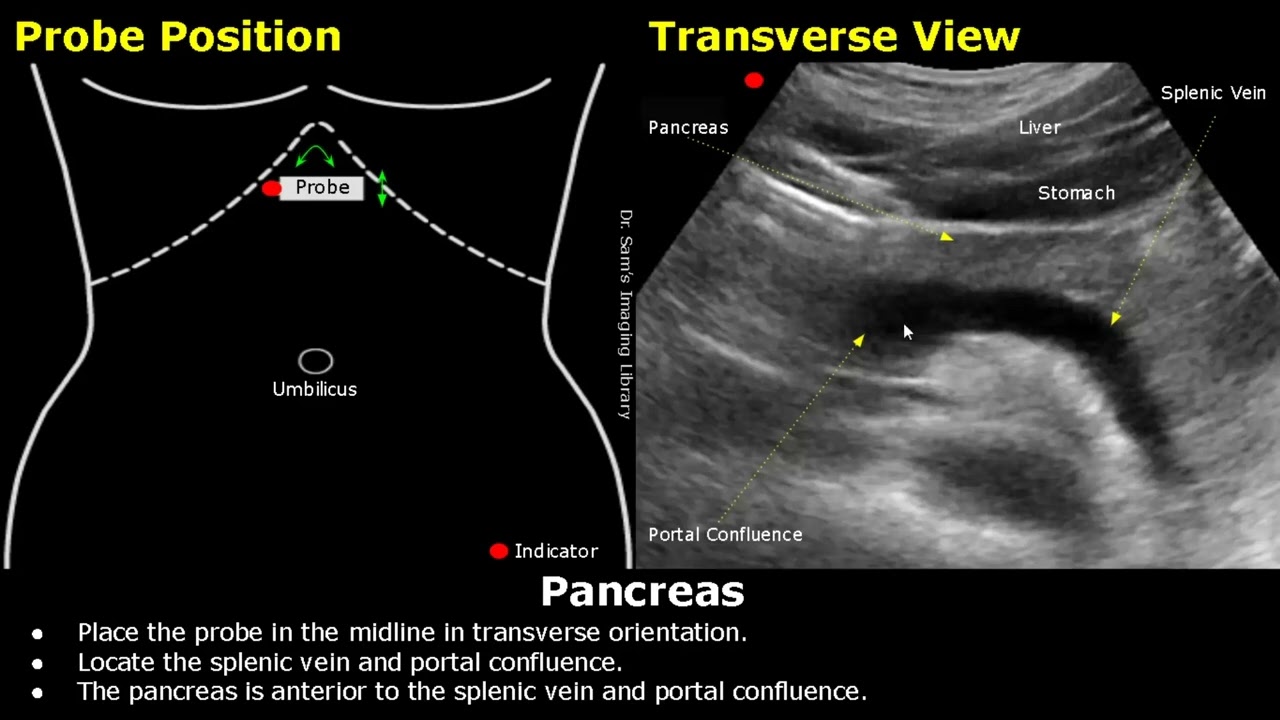 Pancreas Ultrasound Probe Positioning Transducer Placement Scanning Pancreas Ultrasound Probe Positioning Transducer Placement Scanning