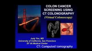 Ucsf Radiology Diagnostic Imaging With Colon Cancer Screening