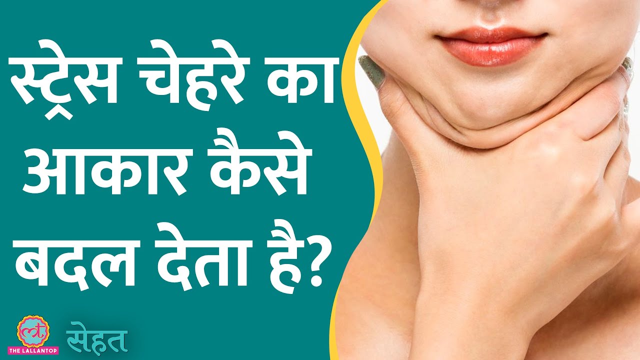 क्या होता है Moon Face जो ज़्यादा Stress लेने से चेहरा बदल देता है? | Sehat ep 672