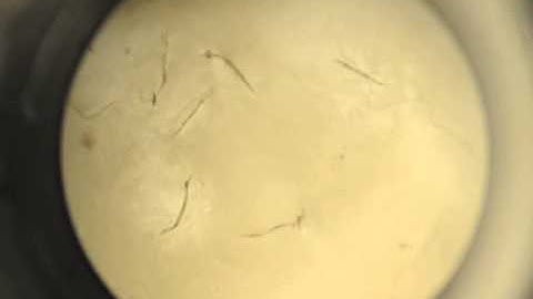 Day 9 elegans CL2006 ADA 2 6:9:2014 DSC 0048