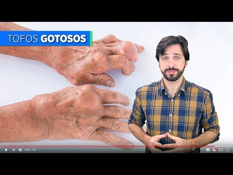O QUE É A DOENÇA GOTA?