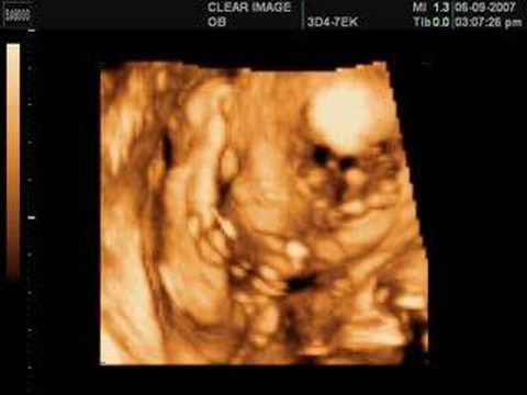 24 weeks pregnant 3d ultrasound 24 weeks pregnant 3d ultrasound