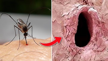 10 Things You Can Only See Under Microscope