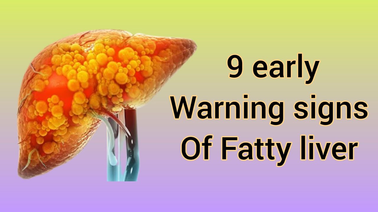 9 warning signs of fatty liver disease signs of liver damage YouTube