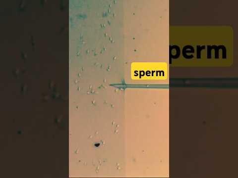 Day In The Life Of An ICSI Sperm Before Injection 
