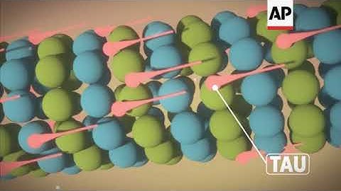 Science Says: How repeated head blows affect the brain ++Animation with soundbites++