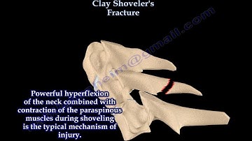 Clay Shoveler