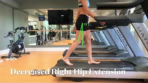 Gait Analysis Project Video