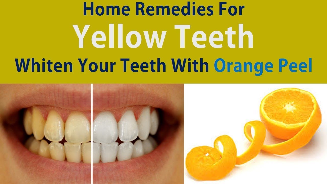 Home Remedies For Yellow Teeth Whiten Your Teeth With Orange Peel