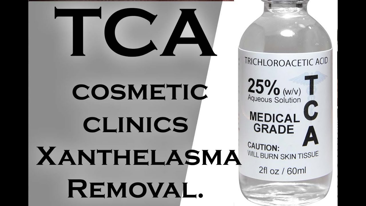 TCA USED IN COSMTETIC CLINICS FOR XANTHELASMA REMOVAL 2 YouTube