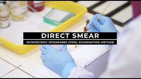 Direct Smear - Microscopic (Standard) Stool Examination Method