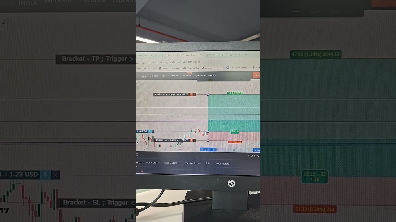 ETH Trade Setup 🚀 Quick Profit Move | Ethereum Trading 