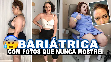 Quem faz bariátrica tem vida normal?