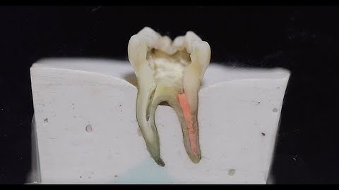 Warm Vertical Compaction Technique From Sectional View.