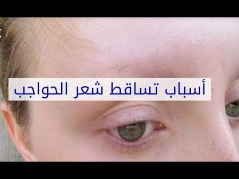 👍 اعرف اسباب تساقط شعر الحاجبين 😧 👀 😢