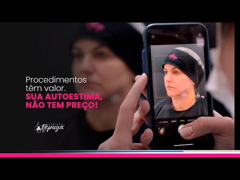 Resultados visíveis da lipo de papada
