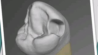 CavSim app || Dental Cavity Trial || screenshot 1
