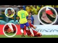 Neymar Jr - Sad Injuries for Brazil 😢