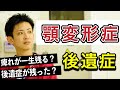 【顎変形症】手術したら痺れが残るって本当？？【知覚麻痺を徹底解説】