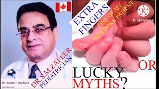 Polydactyly-Lucky Or Myths Dr.s.m.zafeer Pediatrician