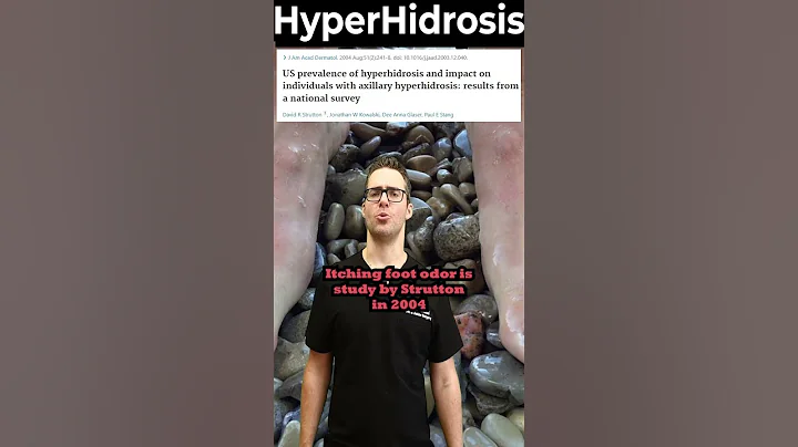 How To Stop Sweaty Feet & Palms! [Hyperhidrosis Treatment]