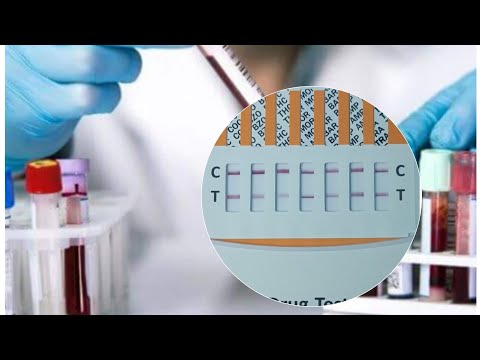 تحليل المخدرات ازاى تطلع سلبى و كم مدة بقاء مخدر الحشيش و الترامادول فى الجسم