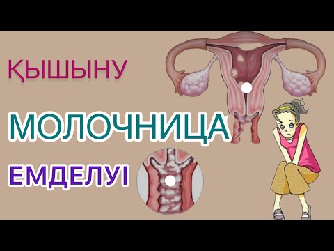 МОЛОЧНИЦА.ЕМІ.КАНДИДОЗ.ҚЫШЫНУ#выделения#молочница#гинеколог