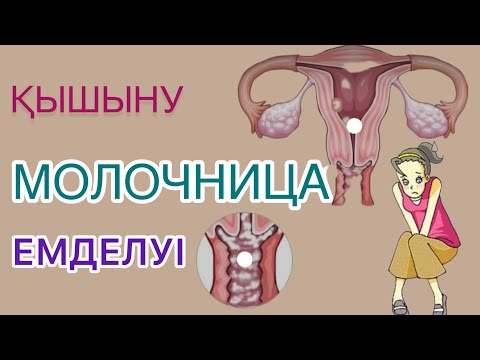 Video: Крингер деген эмне?