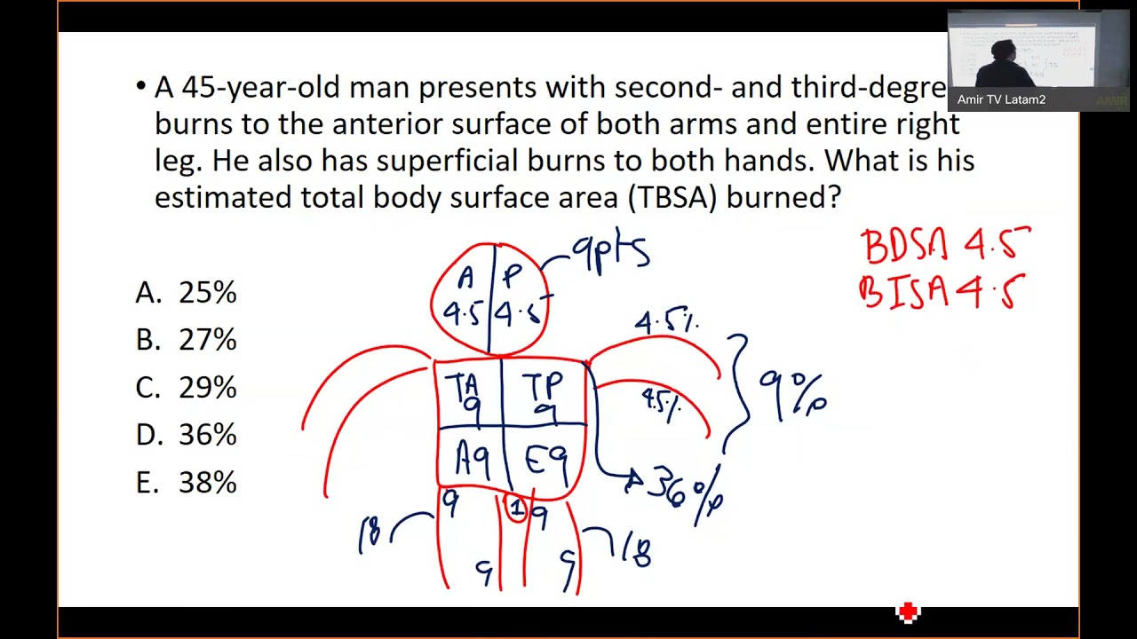 ENARM 2021 clase de Quemaduras