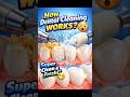 How Dental Cleaning Actually Works 😳 (Not What You Think)