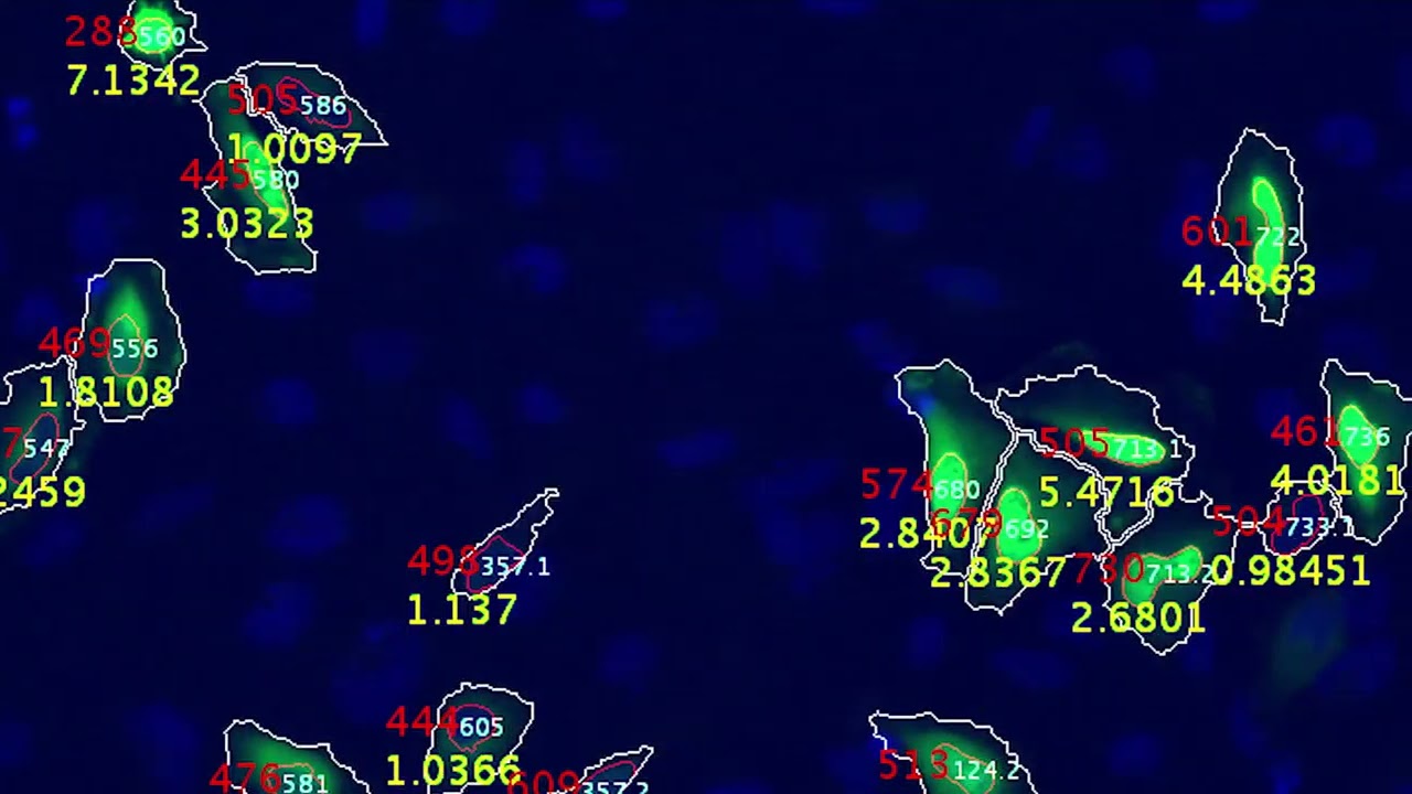 Cancer Diagnostic Tool Uses CRISPR Gene Editing on a Chip