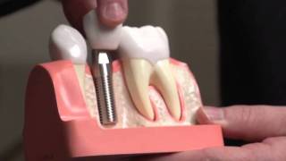 Dr. John Wallace Single Implants Danna Top Docs of DFW Net Worth