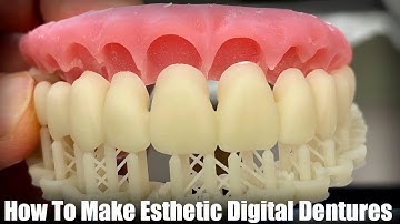 How to Make Esthetic Digital Dentures