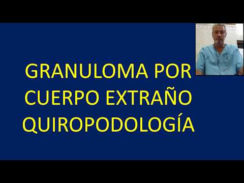 Wideo: Cirugía de Cuerpo Extraño