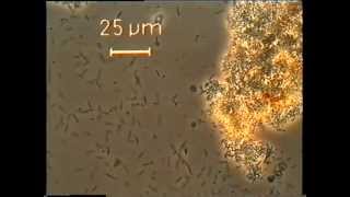 Spiral bacteria