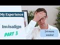 My Invisalign Experience Part 3 - 14 more weeks?!