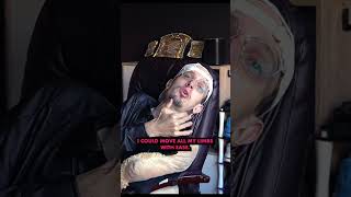 Losing 99% Of My Bodys Movement Due To Bones Growing In My Muscles