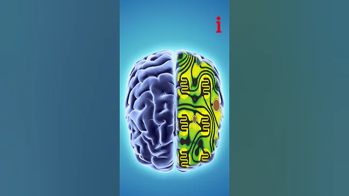 Elon Musk Claims To Have Successfully Implanted The First Microchip In The Human Brain