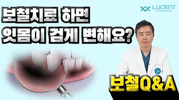 [보철Q&A] 보철치료를 하면 잇몸이 검게 변하나요?
