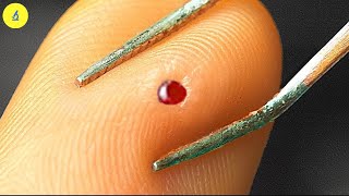 Zooming Into Real Blood Close-Up 1000X Micro And Then .... Tulo - Microscope