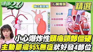 小心爆炸性頭痛 頸部僵硬主動脈瘤95%無症狀好發4部位趙建勳腦動脈瘤破裂猝逝【健康2.0精選】