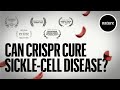 Can CRISPR cure Sickle-cell Disease?