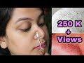 HOW TO REMOVE BLACKHEADS INSTANTLY & PERMANENTLY | PAINLESS HOME REMEDY