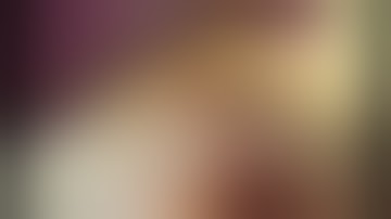 LAPAROSCOPIC TWO STAGE HEPATECTOMY