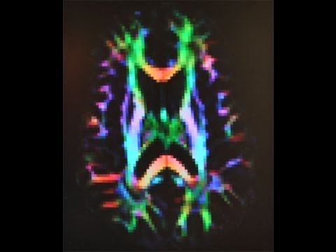 Brain Imaging - YouTube
